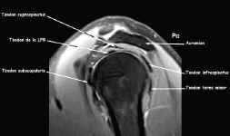 Anatomie IRM en coupe saggitale RHO FAT SAT