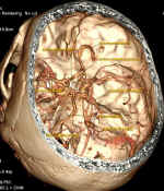anatpolygone2.jpg (39961 octets)