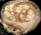 anatpolygone3.jpg (34481 octets)
