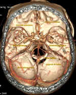 anatpolygone.jpg (37493 octets)