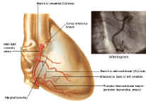  Vue oblique antrieure droite