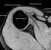 epailIRMax.jpg (28180 octets)
