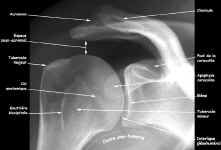 Anatomie de l'épaule de face