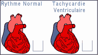 beating_heart2.gif (52447 bytes)
