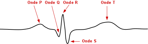 ecg.gif (4058 bytes)