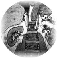Pathologies abdominales