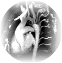 Pathologies vasculaires