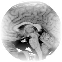 Pathologies du Cerveau