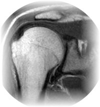 Pathologies osto-articulaires