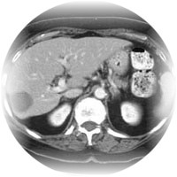 Pathologies hpatiques