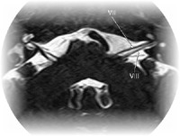 Pathologies O.R.L