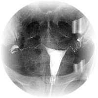 Pathologies gnitales