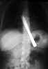Couteau aval