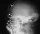 Coup de fusil dans le visage