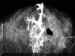 galactorx.jpg (10591 octets)