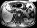pancreas.jpg (26175 octets)