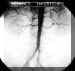 aorte.jpg (8370 octets)