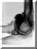 arthrocoud.jpg (10556 octets)