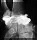 arthropoign.jpg (8604 octets)