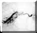 bronchiq.jpg (10635 octets)
